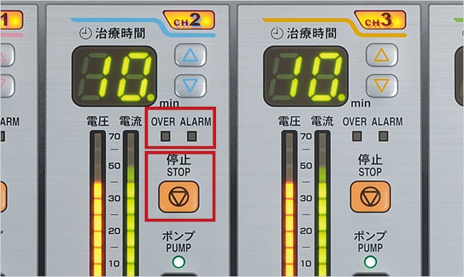 Electrode Peeling Detection Function/ Maximum Output Restriction Function