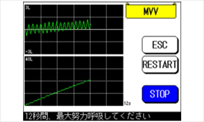 MVV測定画面(AS-507のみ)