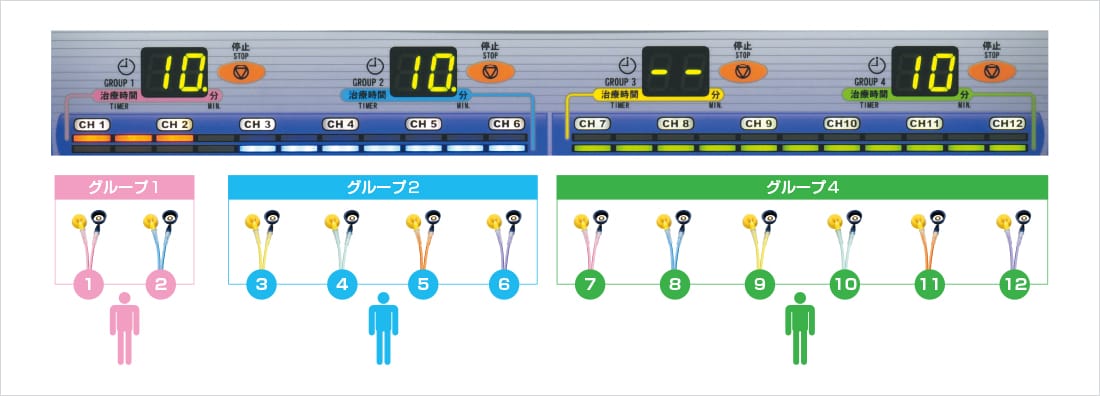治療部位に応じて柔軟にグループ設定