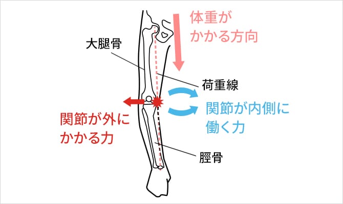 変形性膝関節症のO脚と筋肉の関係